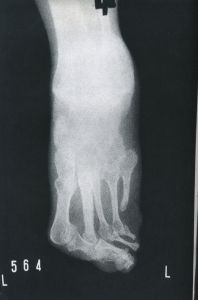 「ヒロシマ / 土門拳」画像9